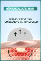 Pimple Patch 22'li Sivilce Bandı / Hidrokolloid Bant / Akne Karşıtı 22li Bant