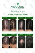 Biberiye Suyu Dökülme Karşıtı ve Saç Uzamasını Destekleyici Saç Toniği %100 Doğal ve Saf 100 ml