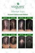Biberiye Suyu Dökülme Karşıtı ve Saç Uzamasını Destekleyici Saç Toniği %100 Doğal ve Saf 100 ml
